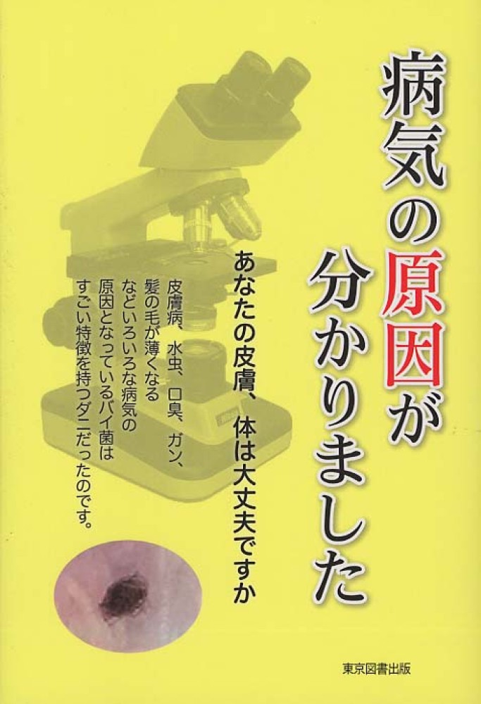 病気の原因が分かりました
